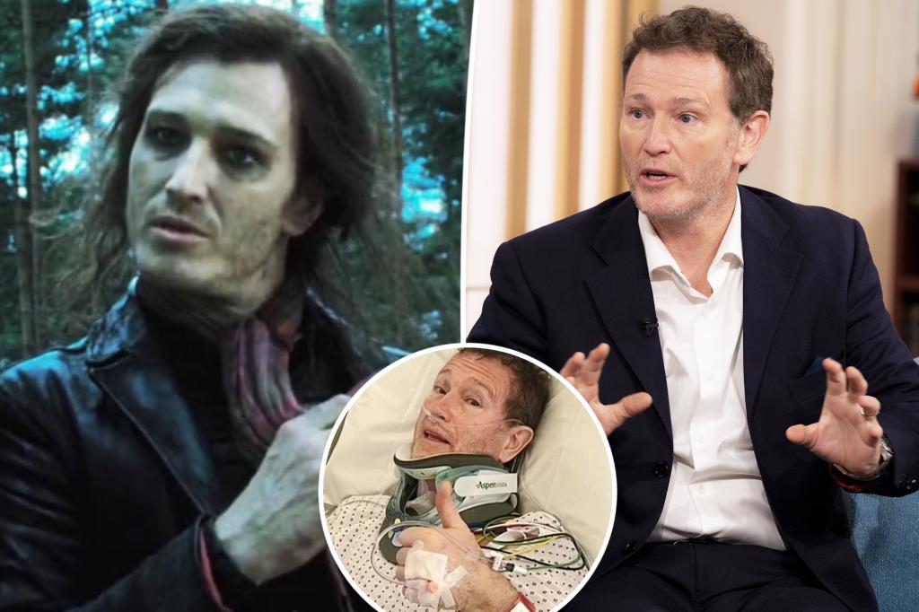 ‘Harry Potter’ actor rushed to hospital with ‘life-threatening’ injury